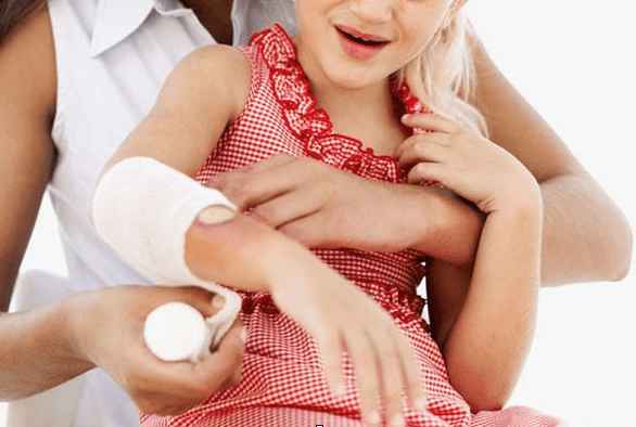 Home remedies to treat the minor burns 1