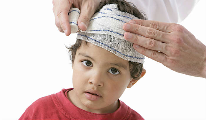 child with head injury